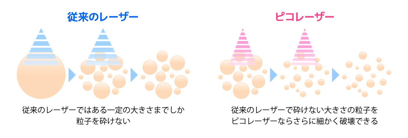 ピコトーニングとは