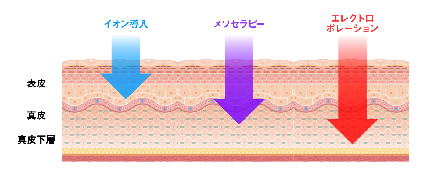 エレクトロポレーションとは